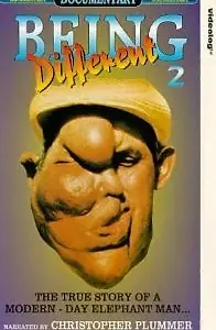 Главный постер фильма «Быть особенным (1981)»