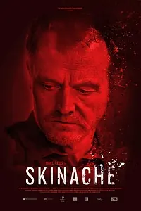 Постер к фильму «Skinache (2017)»