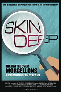 Постер к фильму «Skin Deep: The Battle Over Morgellons (2019)»