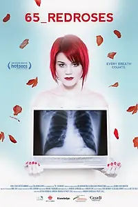 Постер к фильму «65_RedRoses (2009)»