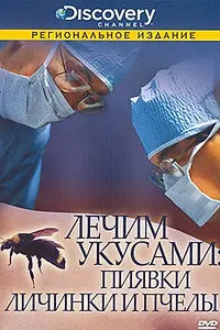 Главный постер фильма «Discovery: Лечим укусами. Пиявки, личинки и пчелы (2000)»