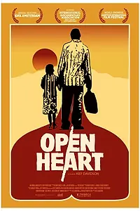 Постер к фильму «Открытое сердце (2013)»