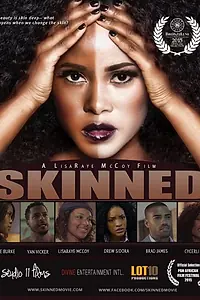 Постер к фильму «Skinned (2015)»