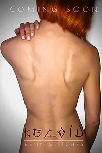 Постер к фильму «Keloid (2017)»